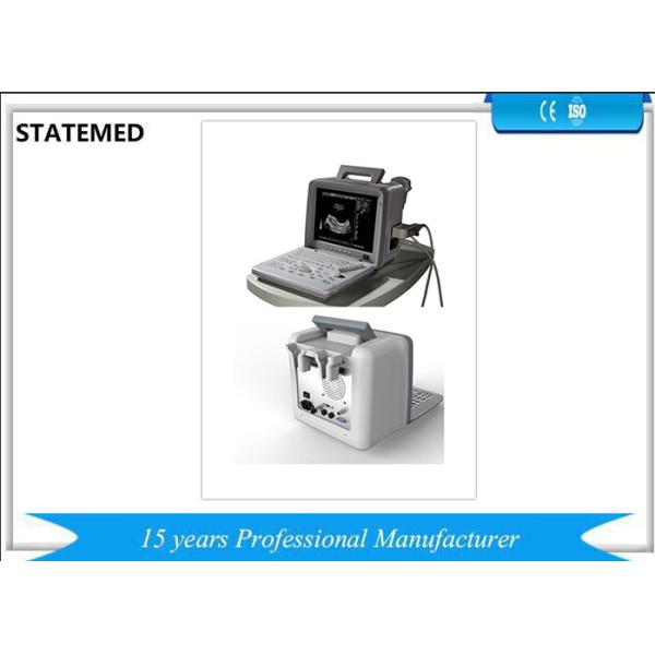 Clinic Digital Ultrasound Scanner With Convex Probe For Abdomen High Precision