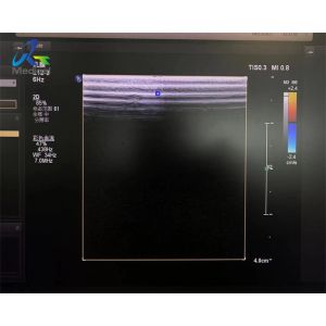 Buy cheap  L12-3 Linear Array Transducer Probe Ultrasound Crystal And Cable Replacement product