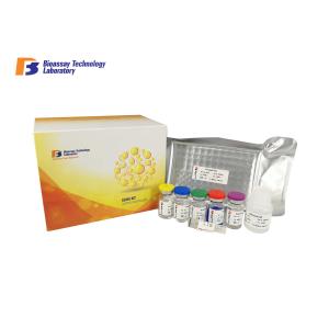 Buy cheap 96 Wells Customized Human Granulocyte-Macrophage Colony Stimulating Factor GM-CSF ELISA Kit from wholesalers
