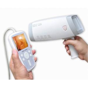 High-Resolution Imaging Digital electronic Colposcope Handheld Video Colposcope