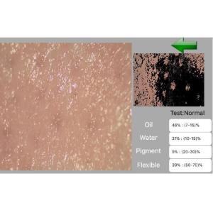 Digital Portable Skin Camera Video Dermatoscope Hair Digital Camera with 200