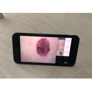 Skin Moisture Detector Wireless Digital Skin Analyzer To Observe Surface Of Skin