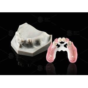 Buy cheap Biocompatibility Dental Telescope White Inner Zirconia Outer Peek Telescope Dental from wholesalers