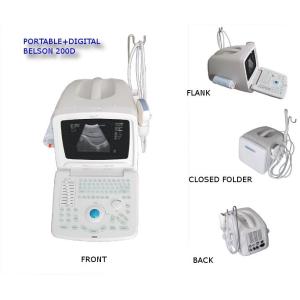 Digital Portable Ultrasound Scanner Movable Color Doppler With 15 Inch LED