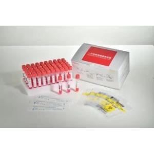 Buy cheap 8ml 5ml PET Ethylene Oxide Sampling Tube With Screw Cap from wholesalers