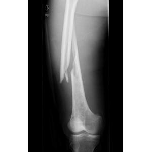 Buy cheap Konida Laser X Ray Medical Imaging from wholesalers