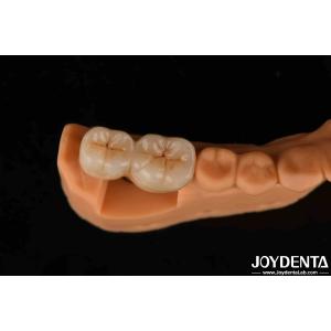 Buy cheap V Shaped Thread Type Finished Abutments Compatibility With All Major Implant Systems from wholesalers