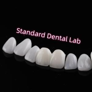 Buy cheap Abrasion Resistant Emax Zirconia Laminate Veneers Incisal Translucency from wholesalers