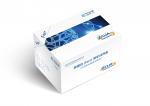Buy cheap Ferritin Quantitative Test Assay Kit CLIA Kit 96 Pieces Per Box from wholesalers