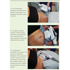 Fast Fat Reduction Sincoheren Fat Freezing Machine With Lcd Touch Screen