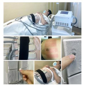 Buy cheap Cryo Slimming Ems Plates Muscle Stimulator Body Sculpting Machine from wholesalers