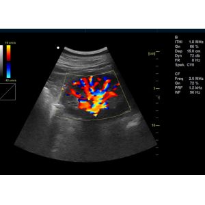 China 15”LED Portable Color Doppler Machine Digital Color Ultrasonic Diagnostic System on sale