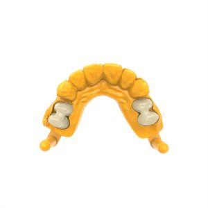 Flexible Clear Permanent Crown Resin for Dental Restorations