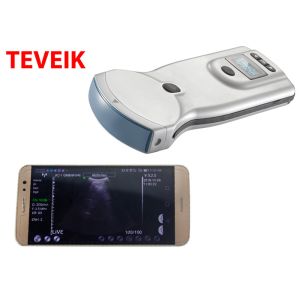 Buy cheap Low Price Wireless Ultrasound Probe Mobile Gyne Ultrasound Machine from wholesalers