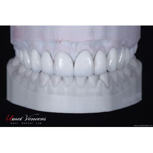 Buy cheap Ultra thin cast porcelain veneer from wholesalers