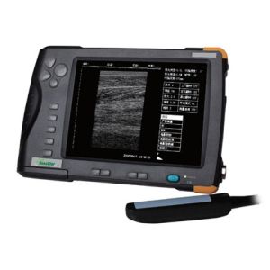 Buy cheap Palm Ultrasound ScannerSU-V5(ultrasonic,black white,Imaging System) from wholesalers