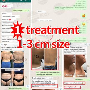 Vacuum Rf Roller Contouring Body Shaping Slimming Machine Vela Shape