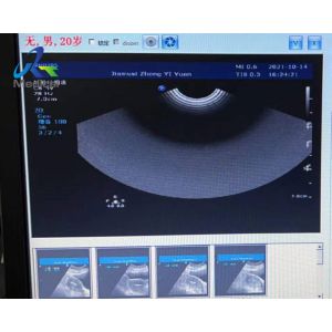 Buy cheap  HD15 Ultrasound Machine Repair Blood Flow Interference Replace ACB Board from wholesalers