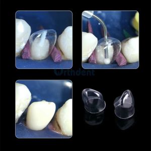 64pcs Dental Crown Matrices Posterior Clear Transparent Strip Matrix 1.911/1.910