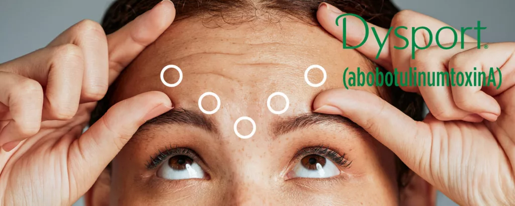 Buy cheap Dysport 500 For Injection abobotulinumtoxinA Botox 500U from wholesalers