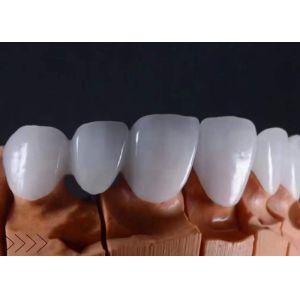 FDA Approved Translucent Zirconia dental Crowns Precise Fit with Natural