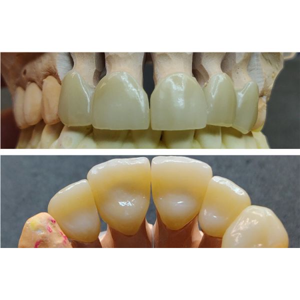 Hot Sale New Dental Lab Material 700-1200mpa 4D Pro Multilayer Zirconia Block