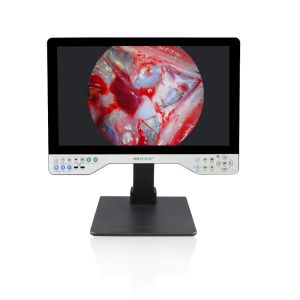 Buy cheap Factory 24 Inch Rigid FHD Endoscope Camera System With Playback And USB Storage Function from wholesalers