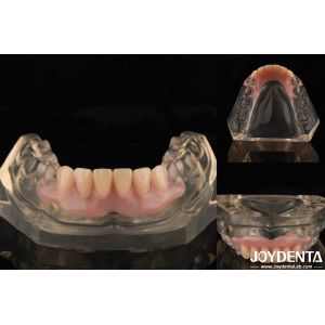 Buy cheap Tooth Arrangement Technology Flexible Denture Finish High Elasticity Customization from wholesalers