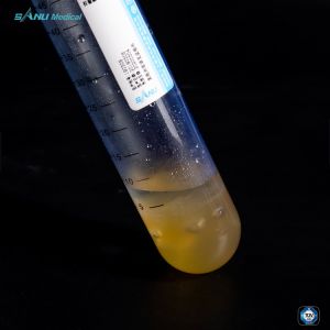 Buy cheap Reduce Inflammation Platelet Rich Plasma Tube PET 50ml For OA Treatment product