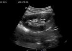 Pocket Wireless Hand Ultrasound Machine Android Windows IOS System Available