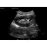 Buy cheap Pocket Wireless Hand Ultrasound Machine Android Windows IOS System Available from wholesalers