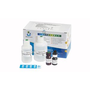 Buy cheap Serum Assay Anti Mullerian Hormone Test Kit AMH CLIA Kit For Adult Females product