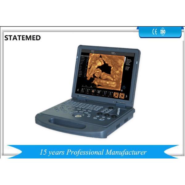 Quality Full Digital Portable Diagnostic Ultrasound Machine Ultrasound Imaging Machine for sale