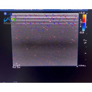 Buy cheap  HD15 Ultrasound Machine Repair Blood Flow Interference Replace ACB Board from wholesalers