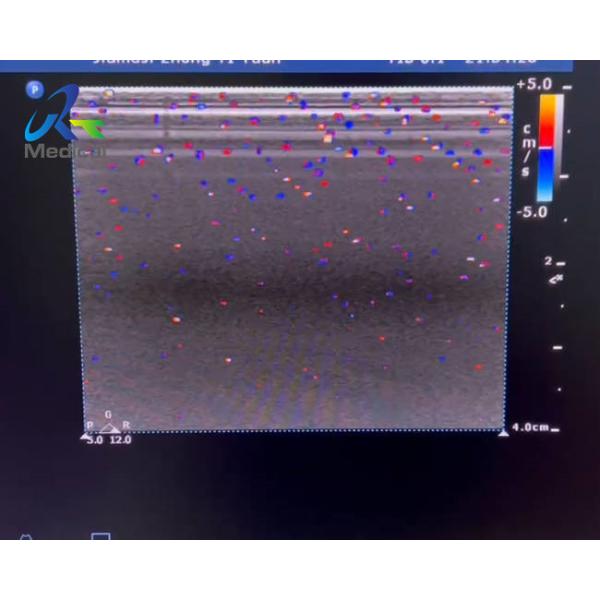 Quality  HD15 Ultrasound Machine Repair Blood Flow Interference Replace ACB Board for sale