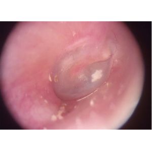 1920 X 1080 Pixels 3.5" Video Ophthalmoscope Device