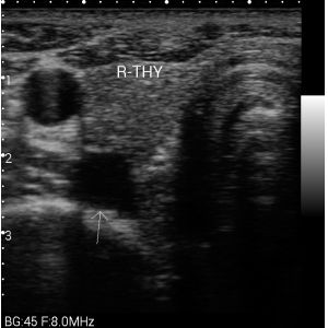 Ultrasonic Transducer Probe Portable Handheld Ultrasound Machine Only 550g