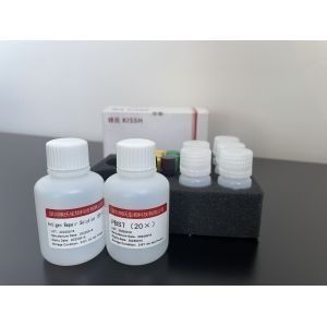 Buy cheap Cytology Assay Reagent TCT Detection Kit With All Optional Consumables from wholesalers