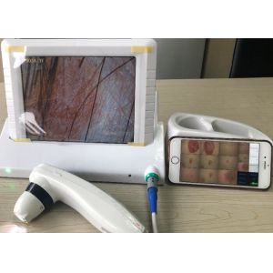 Handhled Digital Skin Moisture And Oil Analyzer With Professional Software