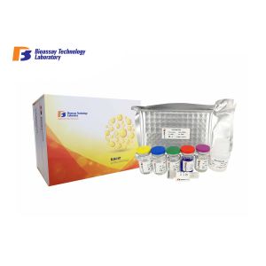 Buy cheap ELISA Kit for Human ALP High Specificity and Sensitivity from wholesalers
