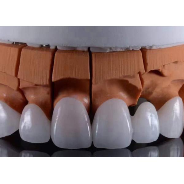 FDA Approved Translucent Zirconia dental Crowns Precise Fit with Natural