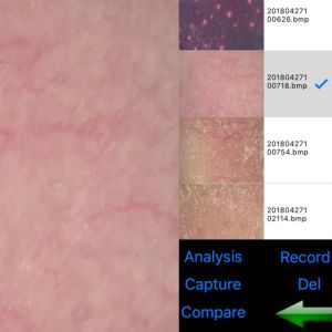 Buy cheap Wifi Skin And Scalp Tester Wireless Skin Analyser Digital With 8" Screen 9 Photoes Displaying from wholesalers