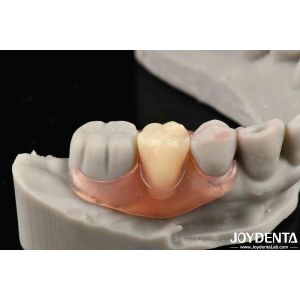 Buy cheap Revolutionize Your Dental Practice Framework Set Up Teeth Finish With Elaborate Technology From Dental from wholesalers