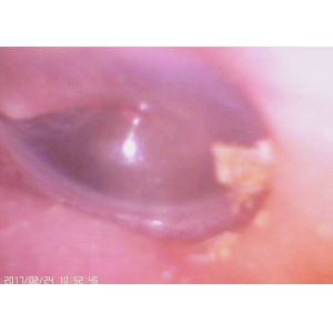 Digital Ear And Nose Inspection Portable Video Otoscope Ophthalmoscope With 3.5