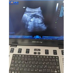 Buy cheap Mindray Laptop Original Ultrasound System M9 Curved array from wholesalers