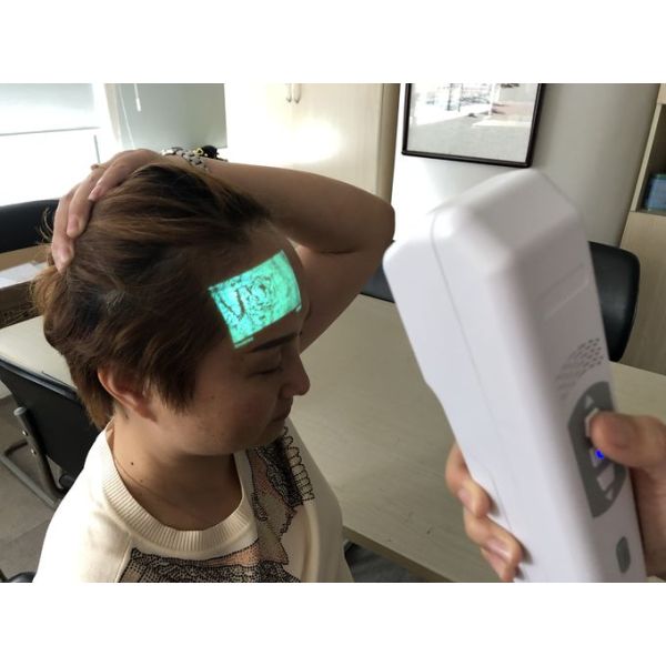 Infrared Wavelengths 850Nm Light Vein Locator Device Depth of Visible Vein ≤12mm Used For Micro Plastic Surgery 0