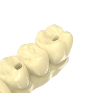 Buy cheap Dental Bridge Resin Biocompatible 3d Printing Resin from wholesalers
