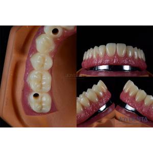 Buy cheap Titanium Multiple Dental Implants Teeth Internal Implants Cracking Resistant Customized from wholesalers