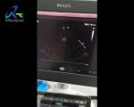 Buy cheap EPIQ 5 Ultrasound Machine Repair Abnormal Image Snowflake Interference Replace ACQ from wholesalers