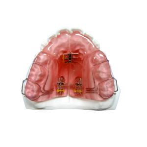 Buy cheap Custom Removable OEM Fixed Orthodontic Appliance Good Durability from wholesalers